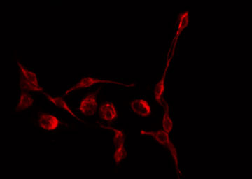 TGFB3 / TGF Beta3 Antibody - Staining COS7 cells by IF/ICC. The samples were fixed with PFA and permeabilized in 0.1% Triton X-100, then blocked in 10% serum for 45 min at 25°C. The primary antibody was diluted at 1:200 and incubated with the sample for 1 hour at 37°C. An Alexa Fluor 594 conjugated goat anti-rabbit IgG (H+L) Ab, diluted at 1/600, was used as the secondary antibody.