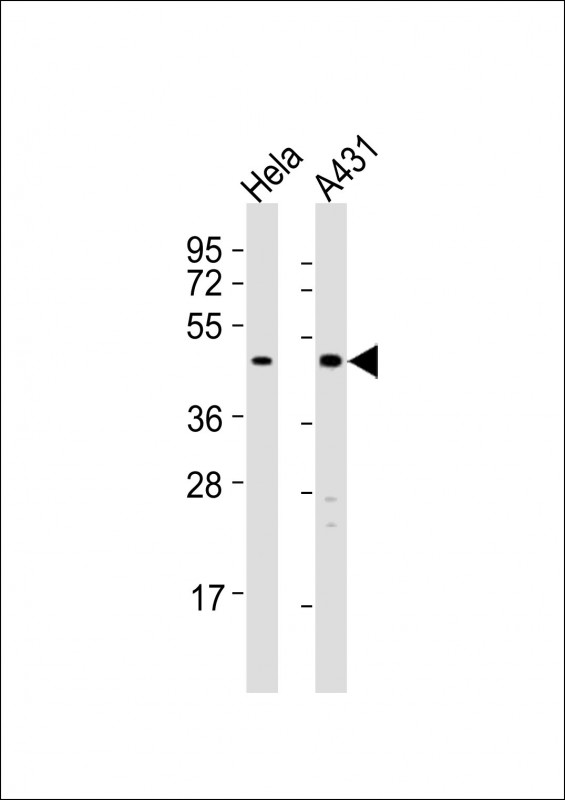TGFB4 / LEFTY2 Antibody - All lanes : Anti-LEFTY2 Antibody at 1:8000 dilution Lane 1: HeLa whole cell lysates Lane 2: A431 whole cell lysates Lysates/proteins at 20 ug per lane. Secondary Goat Anti-Rabbit IgG, (H+L), Peroxidase conjugated at 1/10000 dilution Predicted band size : 41 kDa Blocking/Dilution buffer: 5% NFDM/TBST.