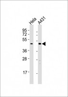 TGFB4 / LEFTY2 Antibody - All lanes : Anti-LEFTY2 Antibody at 1:8000 dilution Lane 1: HeLa whole cell lysates Lane 2: A431 whole cell lysates Lysates/proteins at 20 ug per lane. Secondary Goat Anti-Rabbit IgG, (H+L), Peroxidase conjugated at 1/10000 dilution Predicted band size : 41 kDa Blocking/Dilution buffer: 5% NFDM/TBST.