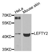 TGFB4 / LEFTY2 Antibody - Western blot analysis of extracts of various cells.