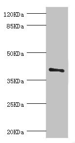 TGFB4 / LEFTY2 Antibody - Western blot All Lanes:LEFTY2 antibody at 2ug/ml+A431 whole cell lysate Secondary Goat polyclonal to rabbit at 1/10000 dilution Predicted band size: 41,38 kDa Observed band size: 41 kDa