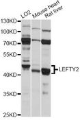 TGFB4 / LEFTY2 Antibody - Western blot analysis of extracts of various cell lines, using LEFTY2 antibody at 1:1000 dilution. The secondary antibody used was an HRP Goat Anti-Rabbit IgG (H+L) at 1:10000 dilution. Lysates were loaded 25ug per lane and 3% nonfat dry milk in TBST was used for blocking. An ECL Kit was used for detection and the exposure time was 5s.