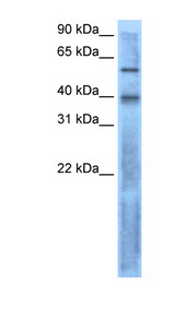 TGFB4 / LEFTY2 Antibody - LEFTY2 antibody Western blot of RPMI 8226 cell lysate. This image was taken for the unconjugated form of this product. Other forms have not been tested.