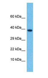 TGFB4 / LEFTY2 Antibody - TGFB4 / LEFTY2 antibody Western Blot of Thymus Tumor. Antibody dilution: 1 ug/ml.  This image was taken for the unconjugated form of this product. Other forms have not been tested.