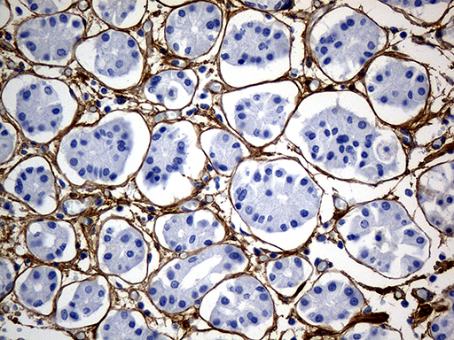 TGFBI Antibody - Immunohistochemical staining of paraffin-embedded Human gastric tissue within the normal limits using anti-TGFBI mouse monoclonal antibody. (Heat-induced epitope retrieval by 1mM EDTA in 10mM Tris buffer. (pH8.5) at 120°C for 3 min. (1:500)