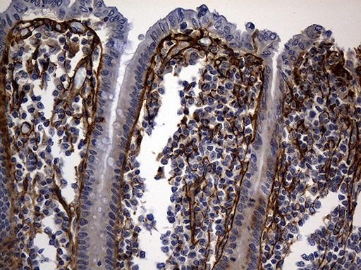 TGFBI Antibody - Immunohistochemical staining of paraffin-embedded Human appendix tissue within the normal limits using anti-TGFBI mouse monoclonal antibody. (Heat-induced epitope retrieval by 1mM EDTA in 10mM Tris buffer. (pH8.5) at 120°C for 3 min. (1:500)