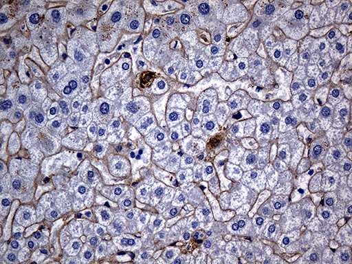 TGFBI Antibody - Immunohistochemical staining of paraffin-embedded Human liver tissue within the normal limits using anti-TGFBI mouse monoclonal antibody. (Heat-induced epitope retrieval by 1mM EDTA in 10mM Tris buffer. (pH8.5) at 120°C for 3 min. (1:500)