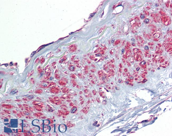 TGFBI Antibody - Anti-TGFBI antibody IHC of human vessel. Immunohistochemistry of formalin-fixed, paraffin-embedded tissue after heat-induced antigen retrieval. Antibody concentration 2.5 ug/ml.  This image was taken for the unconjugated form of this product. Other forms have not been tested.