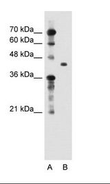 TGFBI Antibody - A: Marker, B: Jurkat Cell Lysate.  This image was taken for the unconjugated form of this product. Other forms have not been tested.