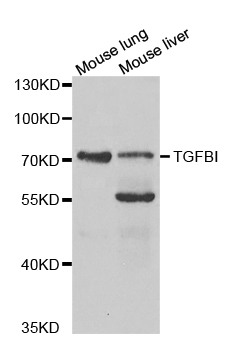 TGFBI Antibody - Western blot analysis of extracts of various cell lines, using TGFBI antibody.