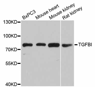 TGFBI Antibody - Western blot analysis of extracts of various cell lines.