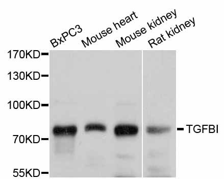 TGFBI Antibody - Western blot analysis of extracts of various cell lines, using TGFBI antibody at 1:1000 dilution. The secondary antibody used was an HRP Goat Anti-Rabbit IgG (H+L) at 1:10000 dilution. Lysates were loaded 25ug per lane and 3% nonfat dry milk in TBST was used for blocking. An ECL Kit was used for detection and the exposure time was 1s.