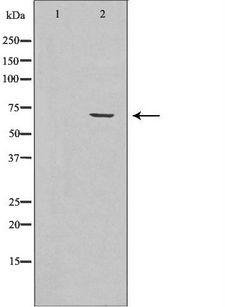 TGFBI Antibody - Western blot analysis of HeLa cell lysates using TGFBI antibody. The lane on the left is treated with the antigen-specific peptide.