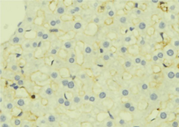 TGFBI Antibody - 1:100 staining mouse liver tissue by IHC-P. The sample was formaldehyde fixed and a heat mediated antigen retrieval step in citrate buffer was performed. The sample was then blocked and incubated with the antibody for 1.5 hours at 22°C. An HRP conjugated goat anti-rabbit antibody was used as the secondary.