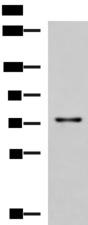TGFBI Antibody - Western blot analysis of Rat liver tissue lysate  using TGFBI Polyclonal Antibody at dilution of 1:850
