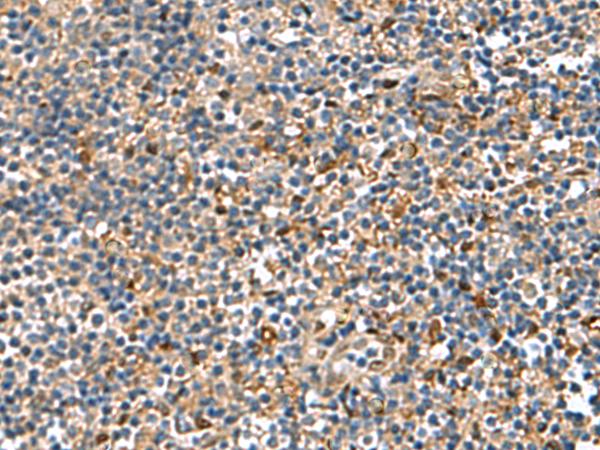 TGFBI Antibody - Immunohistochemistry of paraffin-embedded Human tonsil tissue  using TGFBI Polyclonal Antibody at dilution of 1:75(×200)