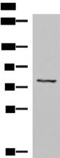 TGFBI Antibody - Western blot analysis of 293T cell lysate  using TGFBI Polyclonal Antibody at dilution of 1:1050