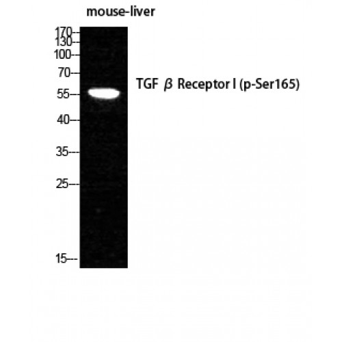 TGFBR1 / ALK5 Antibody - Western blot of Phospho-TGFbeta RI (S165) antibody