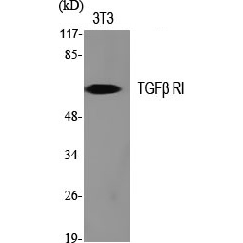 TGFBR1 / ALK5 Antibody - Western blot of TGFbeta RI antibody