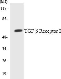 TGFBR1 / ALK5 Antibody - Western blot analysis of the lysates from HeLa cells using TGF Î² Receptor I antibody.