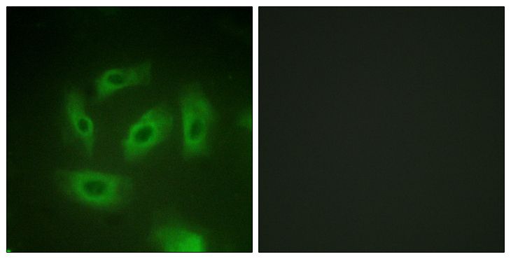 TGFBR1 / ALK5 Antibody - Immunofluorescence analysis of HeLa cells, using TGF beta Receptor I Antibody. The picture on the right is blocked with the synthesized peptide.