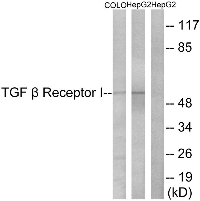 TGFBR1 / ALK5 Antibody - Western blot analysis of lysates from HepG2 and COLO cells, using TGF beta Receptor I Antibody. The lane on the right is blocked with the synthesized peptide.