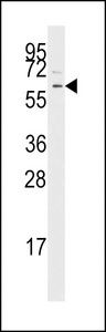 TGFBR1 / ALK5 Antibody - Western blot of anti-TGFBR1 antibody in Jurkat cell line lysates (35 ug/lane). TGFBR1 (arrow) was detected using the purified antibody.