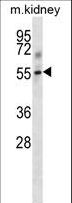 TGFBR1 / ALK5 Antibody - Mouse Tgfbr1 Antibody western blot of mouse kidney tissue lysates (35 ug/lane). The Tgfbr1 antibody detected the Tgfbr1 protein (arrow).