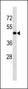 TGFBR1 / ALK5 Antibody - TGFBR1 Antibody western blot of HL-60 cell line lysates (35 ug/lane). The TGFBR1 antibody detected the TGFBR1 protein (arrow).