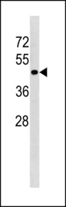 TGFBR1 / ALK5 Antibody - TGFBR1 Antibody western blot of mouse Neuro-2a cell line lysates (35 ug/lane). The TGFBR1 antibody detected the TGFBR1 protein (arrow).