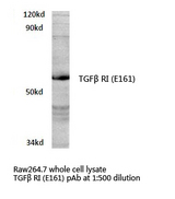 TGFBR1 / ALK5 Antibody - Western blot of TGF RI (E161) pAb in extracts from raw264.7 cells.