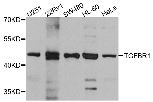 TGFBR1 / ALK5 Antibody - Western blot analysis of extracts of various cell lines, using TGFBR1 antibody at 1:1000 dilution. The secondary antibody used was an HRP Goat Anti-Rabbit IgG (H+L) at 1:10000 dilution. Lysates were loaded 25ug per lane and 3% nonfat dry milk in TBST was used for blocking. An ECL Kit was used for detection and the exposure time was 90s.