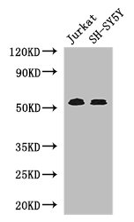 TGFBR1 / ALK5 Antibody - Positive WB detected in:Jurkat whole cell lysate,SH-SY5Y whole cell lysate;All lanes: TGFBR1 antibody at 4ug/ml;Secondary;Goat polyclonal to rabbit IgG at 1/50000 dilution;Predicted band size: 56,57,48 kDa;Observed band size: 56 kDa;