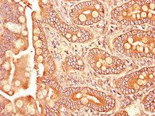TGFBR1 / ALK5 Antibody - Immunohistochemistry of paraffin-embedded human small intestine tissue using TGFBR1 Antibody at dilution of 1:100