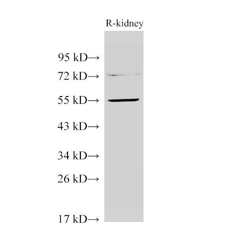 TGFBR1 / ALK5 Antibody - Western Blot analysis of Rat kidney using TGFBR1 Polyclonal Antibody at dilution of 1:1000.