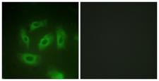 TGFBR1 / ALK5 Antibody - Peptide - + Immunofluorescence analysis of HeLa cells, using TGF ß Receptor I (Ab-165) antibody.