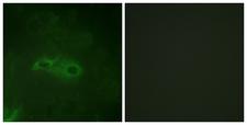 TGFBR1 / ALK5 Antibody - P-peptide - + Immunofluorescence analysis of HeLa cells, using TGF ß Receptor I (Phospho-Ser165) antibody.