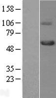 TGFBR1 / ALK5 Protein - Western validation with an anti-DDK antibody * L: Control HEK293 lysate R: Over-expression lysate