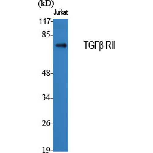 TGFBR2 Antibody - Western blot of TGFbeta RII antibody