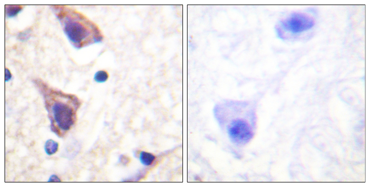 TGFBR2 Antibody - Immunohistochemistry analysis of paraffin-embedded human brain tissue, using TGF beta Receptor II Antibody. The picture on the right is blocked with the synthesized peptide.