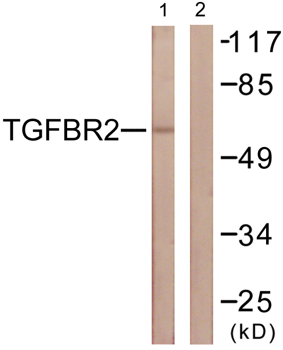 TGFBR2 Antibody - Western blot analysis of lysates from NIH/3T3 cells, using TGF beta Receptor II Antibody. The lane on the right is blocked with the synthesized peptide.