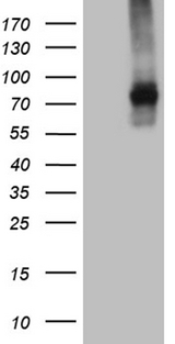 TGFBR2 Antibody - HEK293T cells were transfected with the pCMV6-ENTRY control. (Left lane) or pCMV6-ENTRY TGFBR2. (Right lane) cDNA for 48 hrs and lysed. Equivalent amounts of cell lysates. (5 ug per lane) were separated by SDS-PAGE and immunoblotted with anti-TGFBR2. (1:2000)