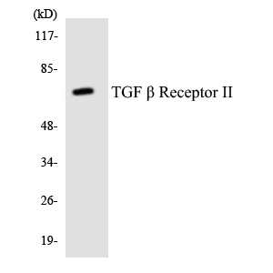 TGFBR2 Antibody - Western blot analysis of the lysates from HT-29 cells using TGF Î² Receptor II antibody.