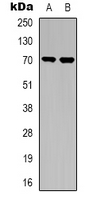 TGFBR2 Antibody - Western blot analysis of TGFBR2 expression in A549 (A); NIH3T3 (B) whole cell lysates.