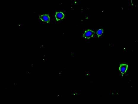 TGFBR2 Antibody - Immunofluorescent analysis of MCF-7 cells using TGFBR2 Antibody at a dilution of 1:100 and Alexa Fluor 488-congugated AffiniPure Goat Anti-Rabbit IgG(H+L)