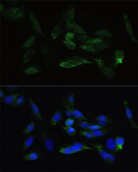 TGFBR2 Antibody - Immunofluorescence analysis of U2OS cells using TGFBR2 antibody at dilution of 1:100. Blue: DAPI for nuclear staining.