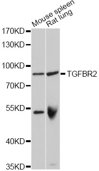 TGFBR2 Antibody - Western blot analysis of extracts of various cell lines, using TGFBR2 antibody at 1:1000 dilution. The secondary antibody used was an HRP Goat Anti-Rabbit IgG (H+L) at 1:10000 dilution. Lysates were loaded 25ug per lane and 3% nonfat dry milk in TBST was used for blocking. An ECL Kit was used for detection and the exposure time was 1s.