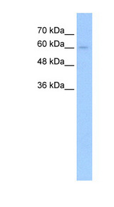 TGFBR2 Antibody - TGFBR2 antibody ARP44743_T100-NP_003233-TGFBR2(transforming growth factor, beta receptor II (70/80kDa)) Antibody Western blot of HepG2 cell lysate.  This image was taken for the unconjugated form of this product. Other forms have not been tested.