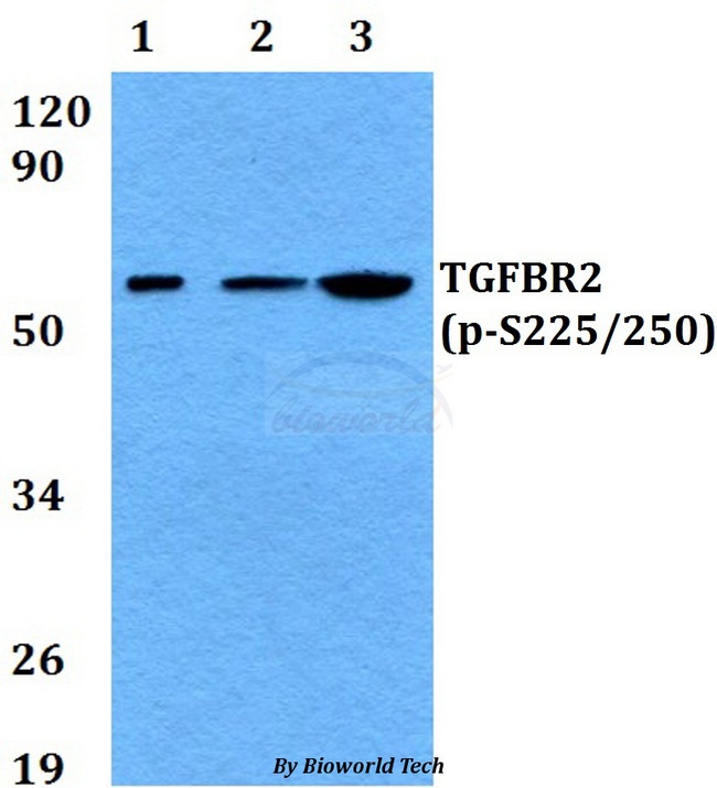 TGFBR2 Antibody - Western blot of p-TGFBR2 (S225/250) antibody at 1:500 dilution. Lane 1: HEK293T cell lysate treated with EGF(0.1ng/ml,30mins). Lane 2: Raw264.7 cell lysate treated with EGF(0.1ng/ml,30mins). Lane 3: H9C2 cell lysate treated with EGF(0.1ng/ml,30mins).