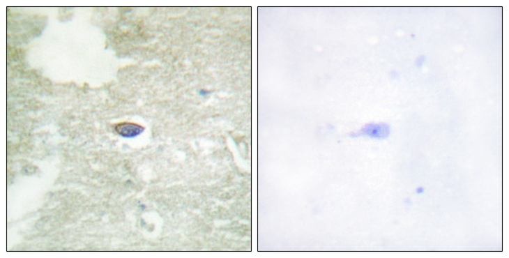 TGFBR2 Antibody - Immunohistochemistry analysis of paraffin-embedded human brain, using TGF beta Receptor II (Phospho-Ser225/250) Antibody. The picture on the right is blocked with the phospho peptide.